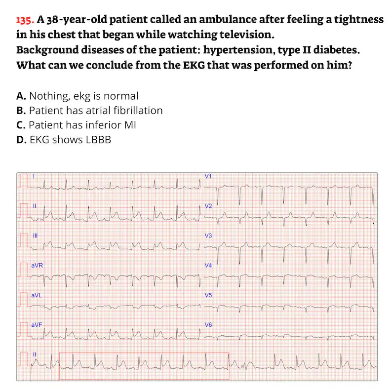 EKG Practice Test With Answers